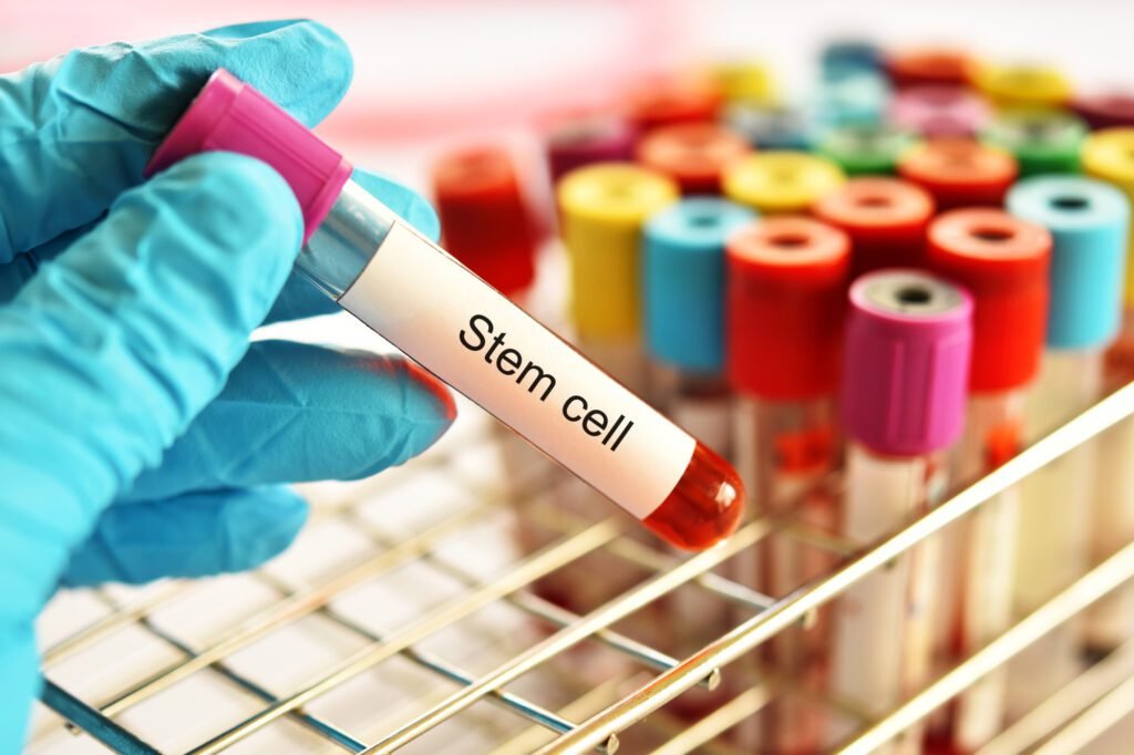 Stem Cell Transplant vs Bone Marrow Transplant: The Differences ...