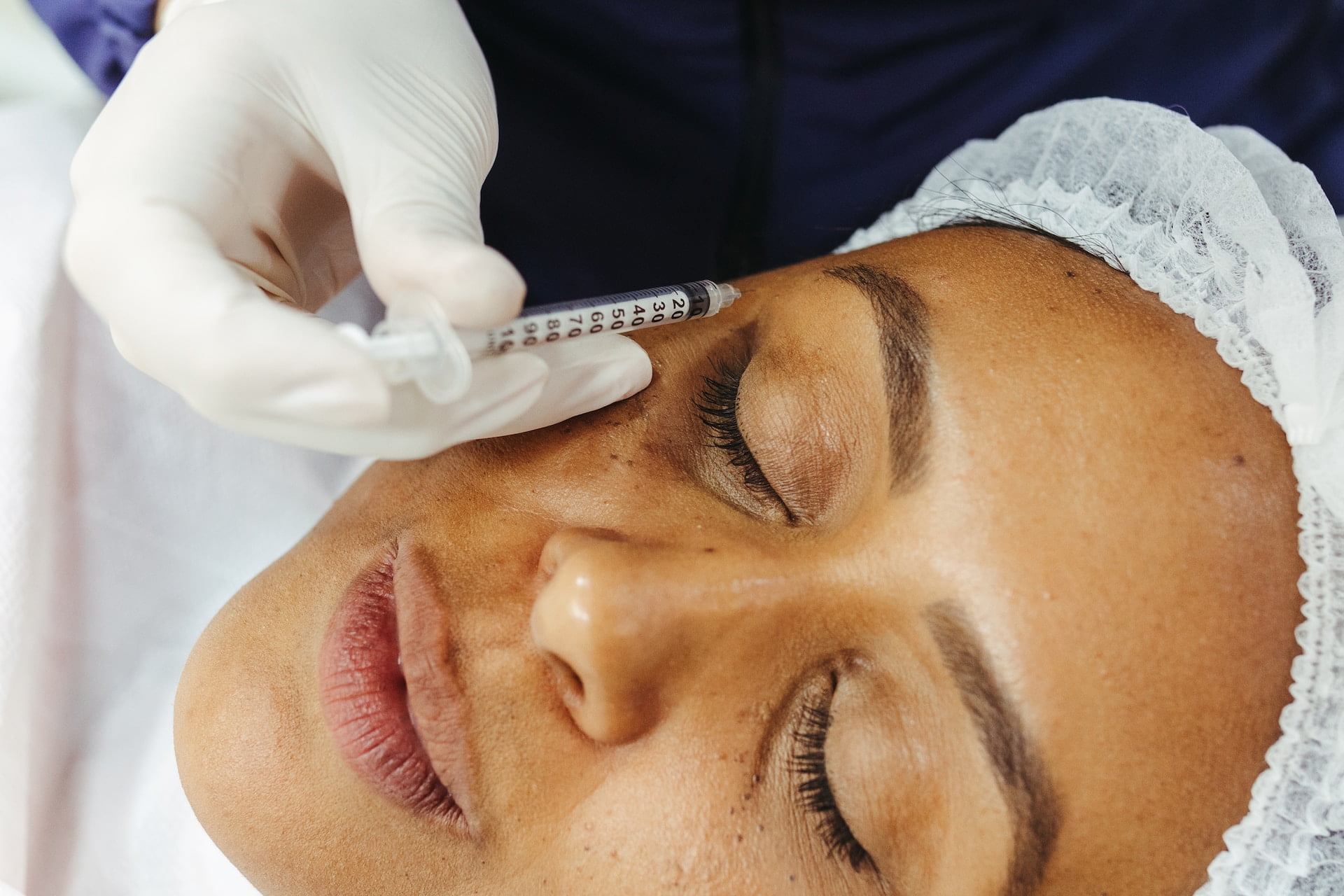 Glow Up with Confidence: Embracing Radiance Through Dermal Fillers